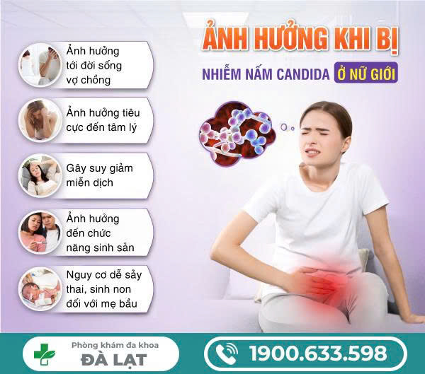 Hình ảnh minh họa